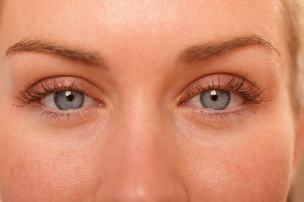 Eyelid Surgery in Riyadh