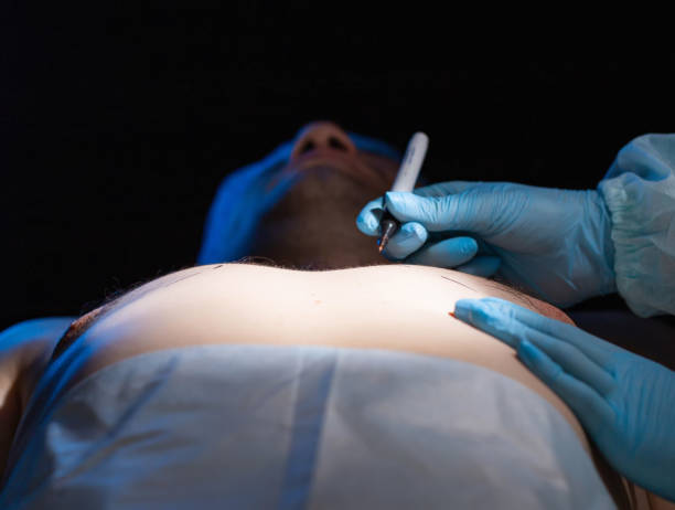 Gynecomastia Surgery in Riyadh