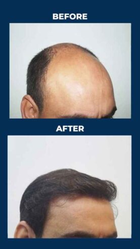 Personiks Reviews Hyderabad | Best Rated Cosmetic Surg
