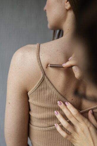 How to Treat Back Acne and Its Effects?