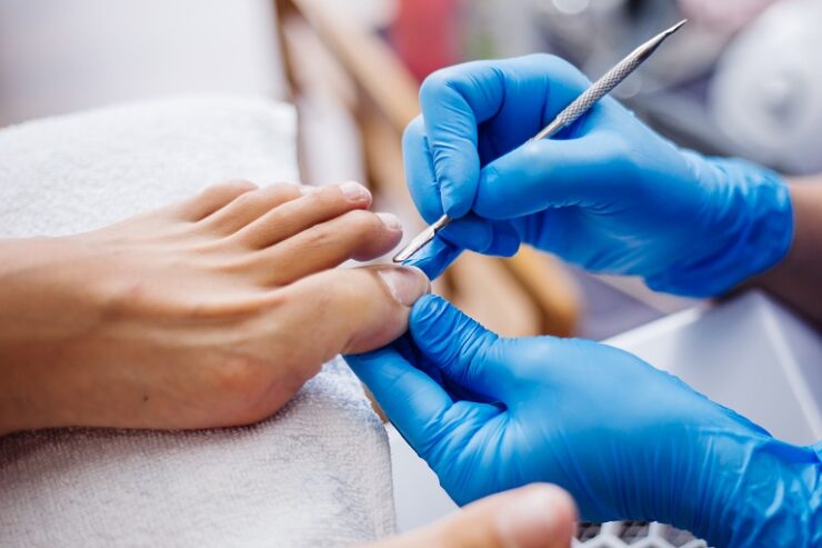 Ingrown toenail surgery in Riyadh
