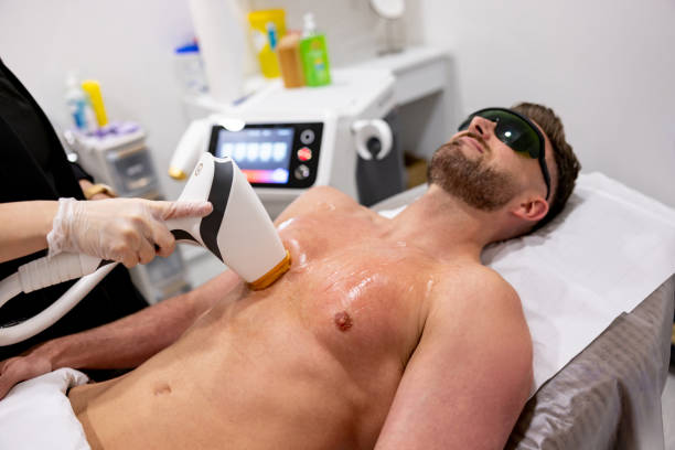 What You Need to Know Before Your Laser Hair Removal