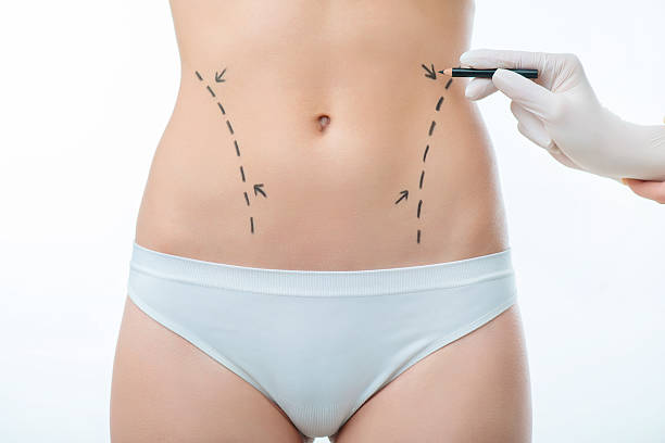 Non-Surgical Alternatives to Liposuction in Riyadh: