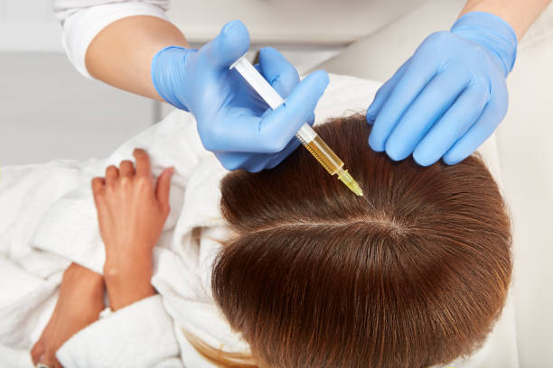 PRP Hair Treatment in Riyadh