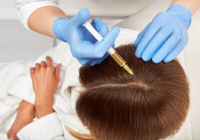 PRP-Hair-Treatment-4