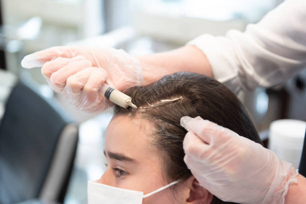 PRP Hair Treatment in Riyadh