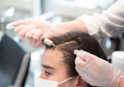 PRP-hair-treatment-in-Riyadh-10