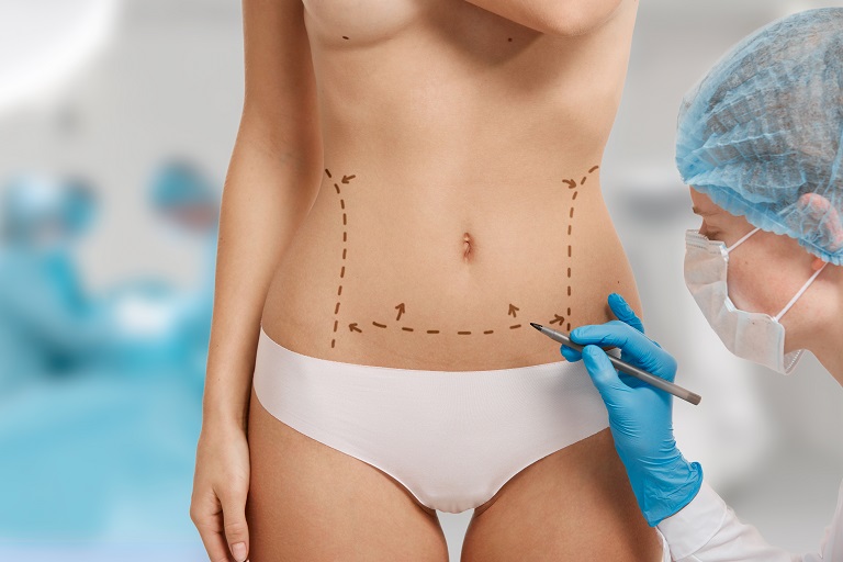 Tummy Tuck surgery in Riyadh
