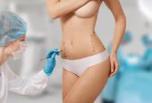 Tummy Tuck surgery in Riyadh