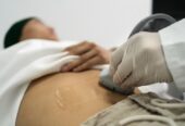 Laser liposuction in Riyadh