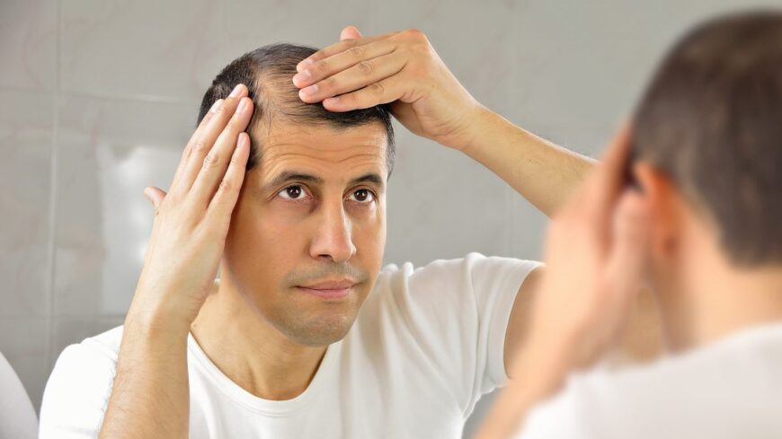 VCare Hair Clinic – Your Trusted Destination for Advan
