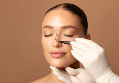 جراحة-تجميل-الأنف-في-الرياض-10