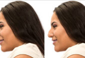 The cost of rhinoplasty in Saudi Arabia