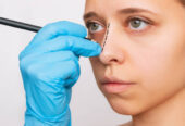Rhinoplasty cost in Saudi Arabia