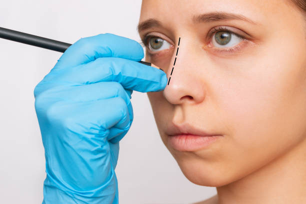 Rhinoplasty cost in Saudi Arabia
