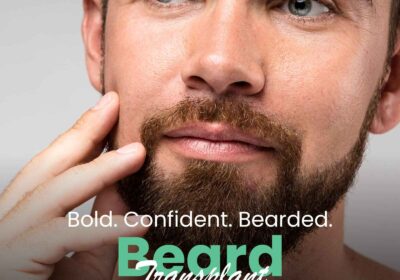 1st-post-Beard-Transplant