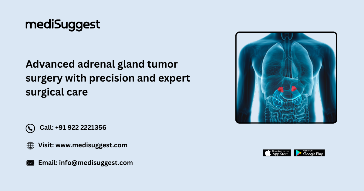 Adrenal gland cancer surgery Hitec City