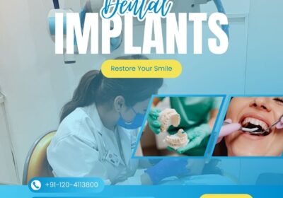 Dental-implants-in-Indirapuram