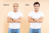 Life Slimming And Cosmetic Clinic | Banjara Hills