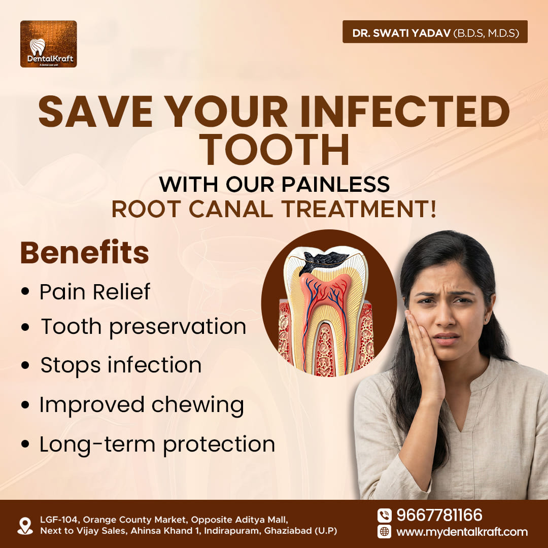 RCT clinic in Indirapuram offering precise root canal