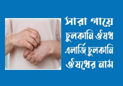 সারা-গায়ে-চুলকানি-ঔষধ-এলার্জি-চুলকানি-ঔষধের-নাম