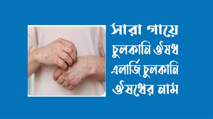 চুলকানির ঔষধের নাম স্কয়ার নিয়ে তথ্যভিত্তিক আলোচনা
