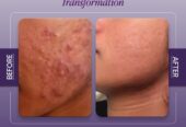 Allodermis Skin Clinic