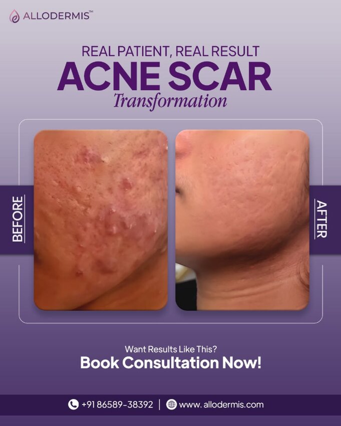 Allodermis Skin Clinic